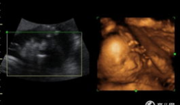 四维视频,四维视频揭示的视觉奇观与未来科技展望